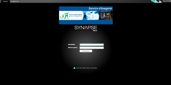 Interface Synapse